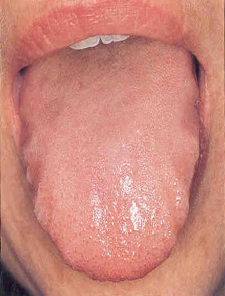 Tongue scallops