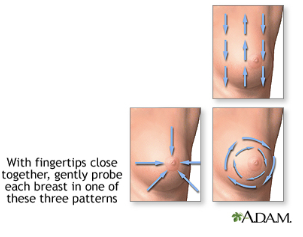 Illustration showing directions to palpate breasts with fingertips during self exam.