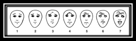 FACES Pain Rating Scale