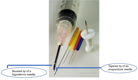 The tapered tip of an acupuncture needle is compared against the beveled tip of a hypodermic needle