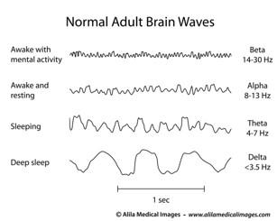 Different brain wave signatures of a normal adult