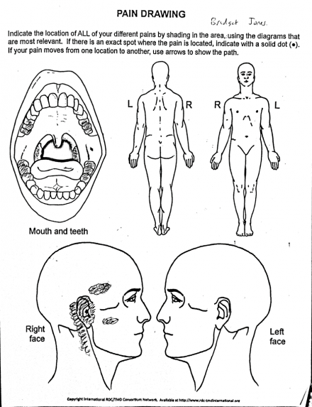 Pain drawing showing front and back of body and separate views of mouth and either side of head
