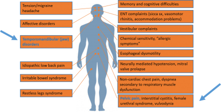 Central sensitization and overlapping pain conditions diagram