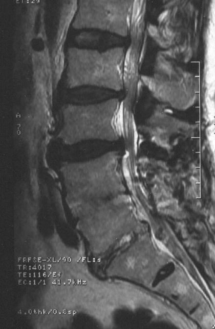 Spine imaging