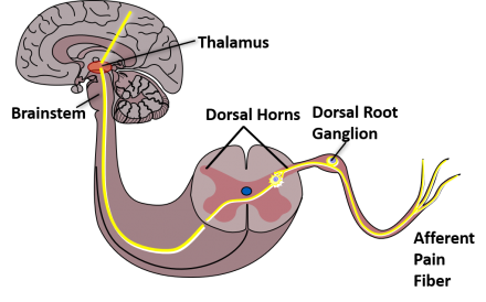 A representation of the brain and dorsal horn of the spine cord which highlights the pathway pain travels from the dorsal horn to the brain where it is interpreted.