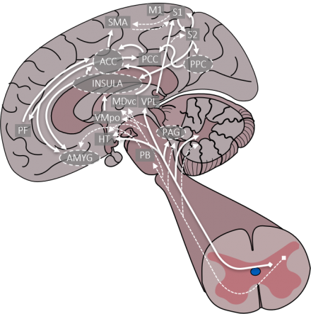 A representation of the brain and spinal depicting the nociceptive impulse traveling through the regions of brain as it is being perceived.