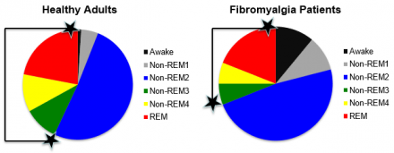 Two pie graphs show the amount of time healthy adults versus fibromyalgia patients spend in sleep stages.