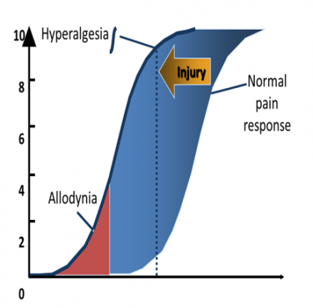 Chart showing the area under a curve related to hyperalgesia and allodynia. Both responses are skewed outside the normal range of pain response.