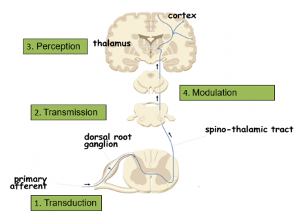 Illustration showing pain processing from the dorsal root ganglion through the spino-thalamic tract to the thalamus and cortex