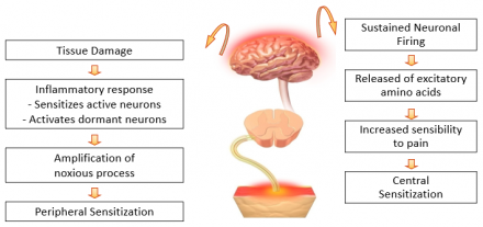Illustration showing consequences of pain through the spinothalamic framework leading to and from the brain.