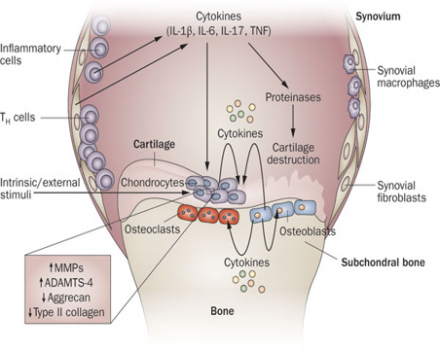 Illustration shows The levels of proinflammatory cytokines, including IL-1β, TNF and IL-6, are elevated in OA. These cytokines contribute to the pathogenesis of OA through several mechanisms, including downregulation of anabolic events and upregulation of catabolic and inflammatory responses, effects that result in structural damage to the OA joint. Abbreviations: ADAMTS, a disintegrin-like and metalloproteinase with thrombospondin type 1 motifs; IL, interleukin; MMP, matrix metalloproteinase; OA
