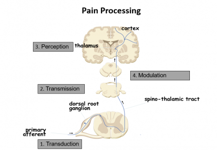 Pain processing diagram showing signals going from the dorsal root ganglion through the spino-thalamic tract to the cortext