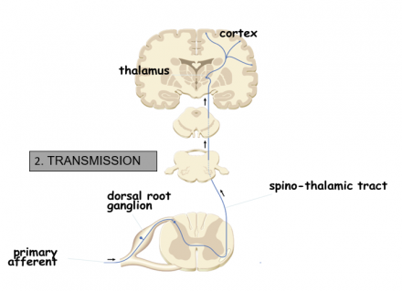 Diagram of transmission.
