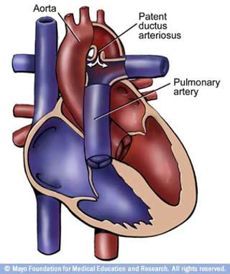 Illustration of a heart with interior structures shown.