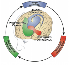 Illustration shows interlinked pieces of the brain (basal ganglia, prefrontal corext, and extended amygdala) and the corresponding linked parts of opioid use disorder: (binge/intoxication, withdrawal/negative affect, and preoccupation/anticipation, respectively)